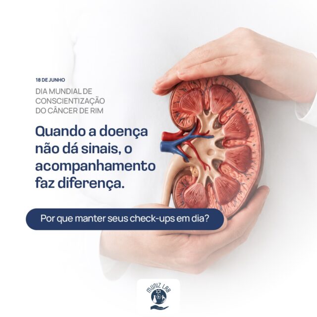 Nem todas as condições de saúde apresentam sintomas nas fases iniciais, e isso também acontece com algumas doenças que afetam os rins.Por esse motivo, acompanhar a saúde regularmente e manter os exames em dia pode ajudar na identificação precoce de alterações, especialmente em pessoas com fatores de risco, histórico familiar ou condições crônicas que exigem acompanhamento.No Dia Mundial de Conscientização do Câncer de Rim, o lembrete é simples: esperar os sintomas aparecerem nem sempre é o melhor caminho.‼️Conte com a equipe do Munizlab para cuidar da sua saúde! 💙#munizlab #clinicadrmuniz #cancerderim