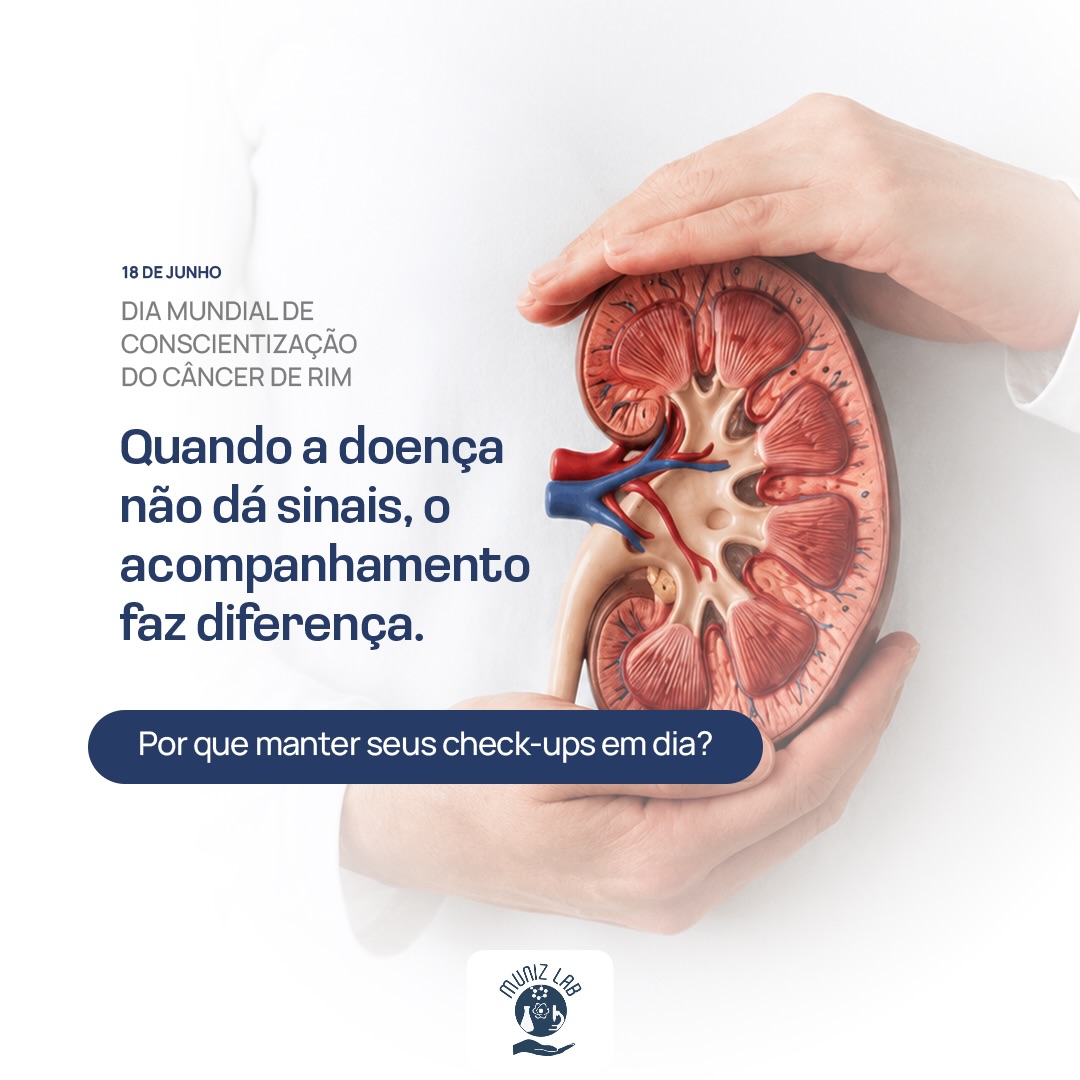 Nem todas as condições de saúde apresentam sintomas nas fases iniciais, e isso também acontece com algumas doenças que afetam os rins.Por esse motivo, acompanhar a saúde regularmente e manter os exames em dia pode ajudar na identificação precoce de alterações, especialmente em pessoas com fatores de risco, histórico familiar ou condições crônicas que exigem acompanhamento.No Dia Mundial de Conscientização do Câncer de Rim, o lembrete é simples: esperar os sintomas aparecerem nem sempre é o melhor caminho.‼️Conte com a equipe do Munizlab para cuidar da sua saúde! 💙#munizlab #clinicadrmuniz #cancerderim
